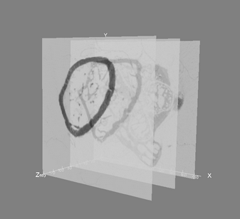 Bone sample displayed in slice rendering mode with transparency
