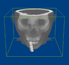 Dilation by an octahedron of size three