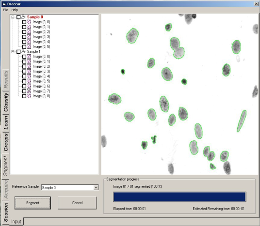 Cell segmentation