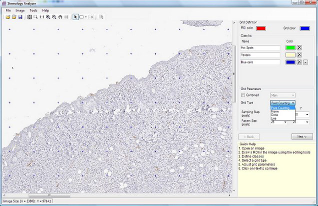 Stereology Analyzer