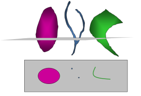 Stereology Analyzer 3D and 2D