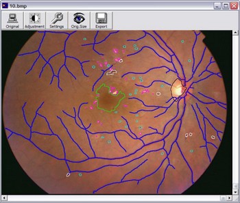 Retina image