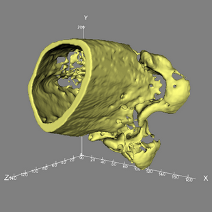 Bone isosurface