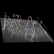 Nerve Plexus Analysis