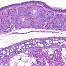 Sebaceous Glands Analysis