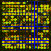 Microarray Analysis