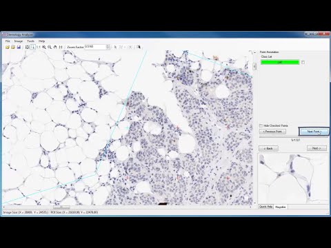 ADCIS Vertical Products : Stereology Analyzer : Getting started