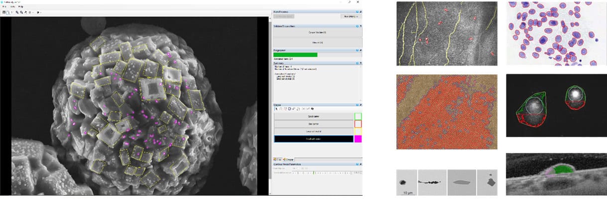 Annotation can be of many kinds : identification, classification, segmentation, measures