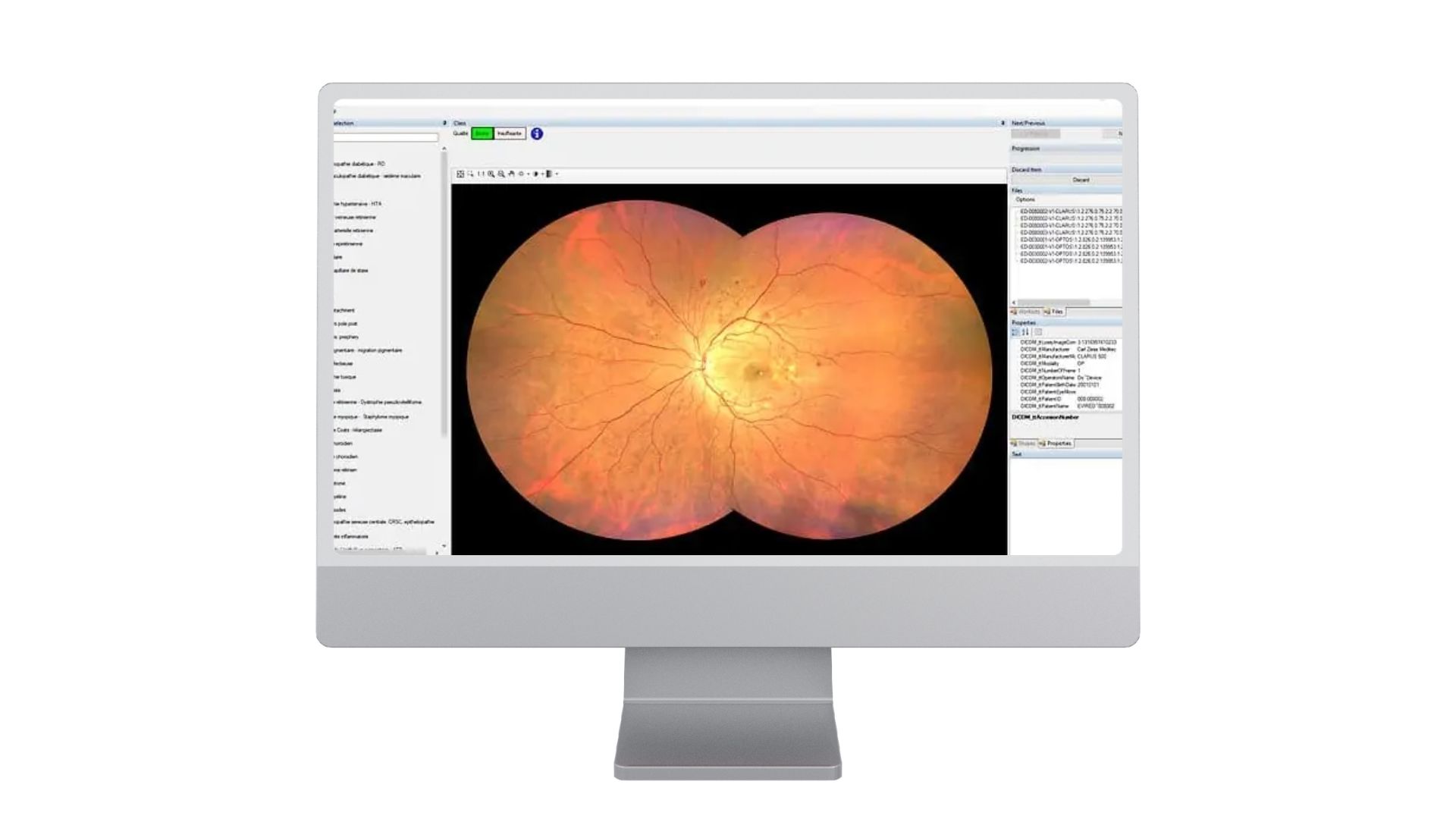 ADCIS_computer_vision_AI_Software_key_benefit_Anotate ADCIS_computer_vision_AI_Software_key_benefit_Anotate