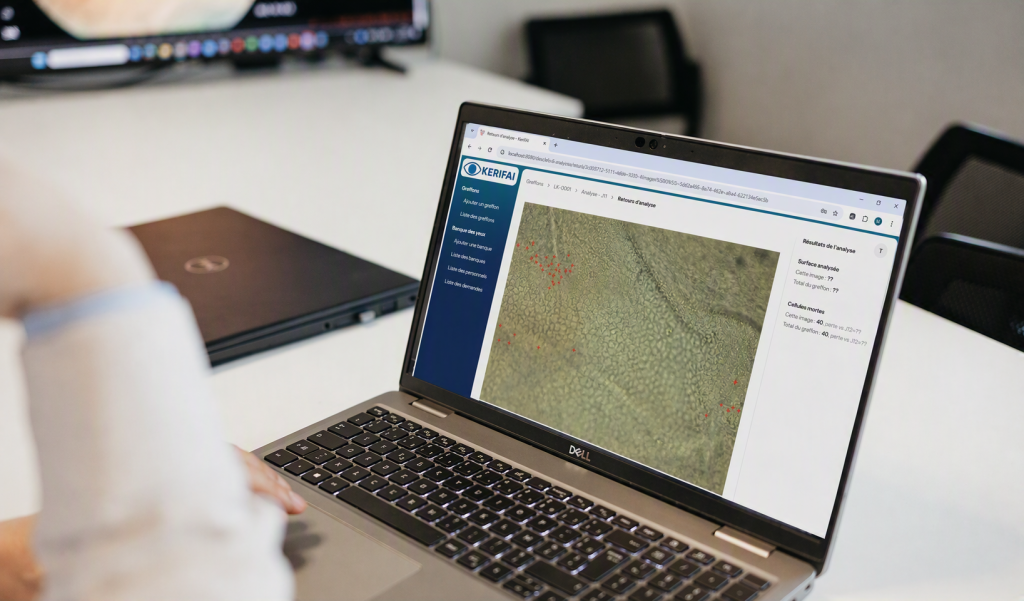 ADCIS_computer_vision_AI_Software_ophthalmology_KERIFAI